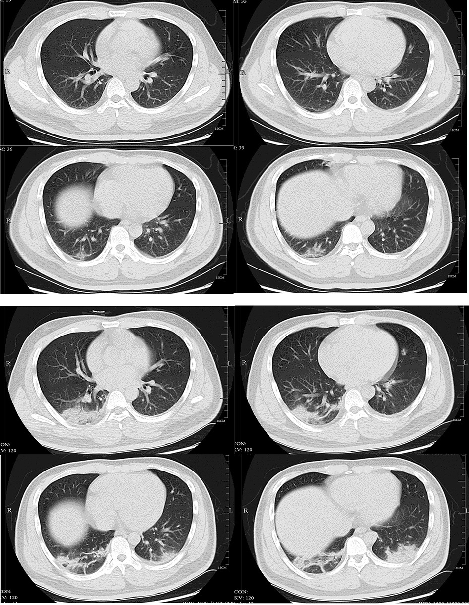 Fig 1